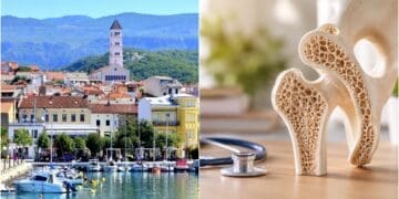Osteoporoza često prolazi bez simptoma! U Crikvenici organiziran besplatan preventivni pregled